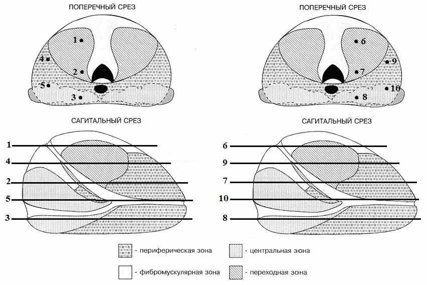 Транзиторная зона предстательной железы. Схема строения предстательной железы. Зональная анатомия предстательной железы. Зональное строение предстательной железы. Анатомия предстательной железы схема.
