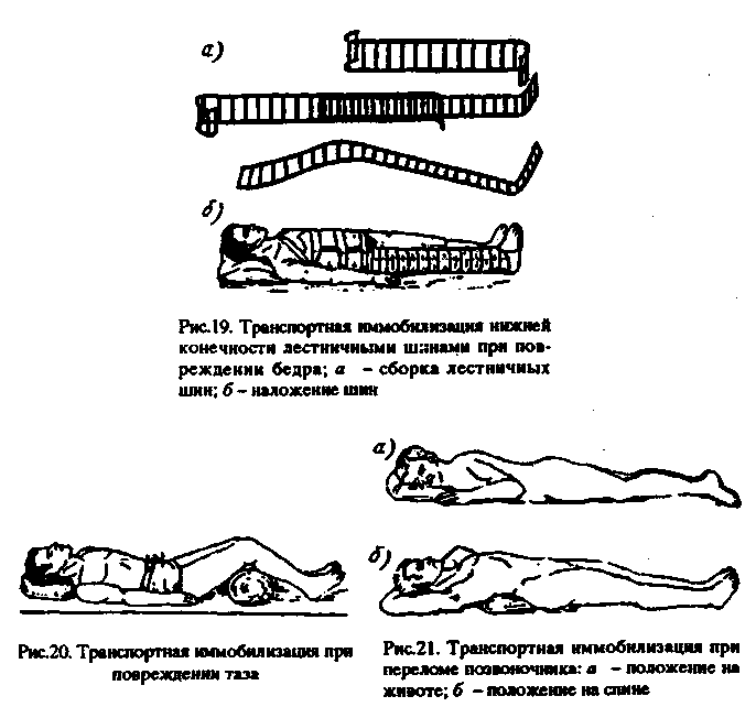 Транспортная иммобилизация шейный отдел позвоночника. Иммобилизация при повреждении грудного отдела позвоночника. Иммобилизация при травме шейного отдела позвоночника. Транспортная иммобилизация при переломе шейного отдела позвоночника. Транспортная иммобилизация позвоночника в грудном отделе.