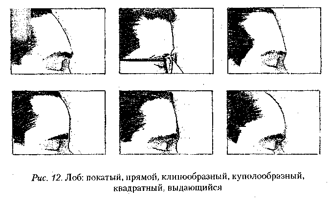 Описание в криминалистике. Положение лба криминалистика. Форма затылка криминалистика. Форма лба криминалистика. Описание лба криминалистика.