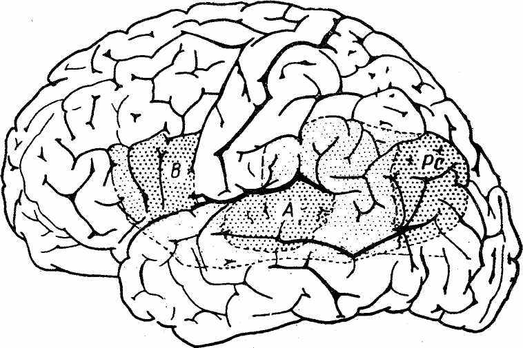 Brain zone. Зона Брока и Вернике. Зона Вернике поля Бродмана. Височный отдел коры головного мозга акустико гностическая афазия. Зона Дежерина.