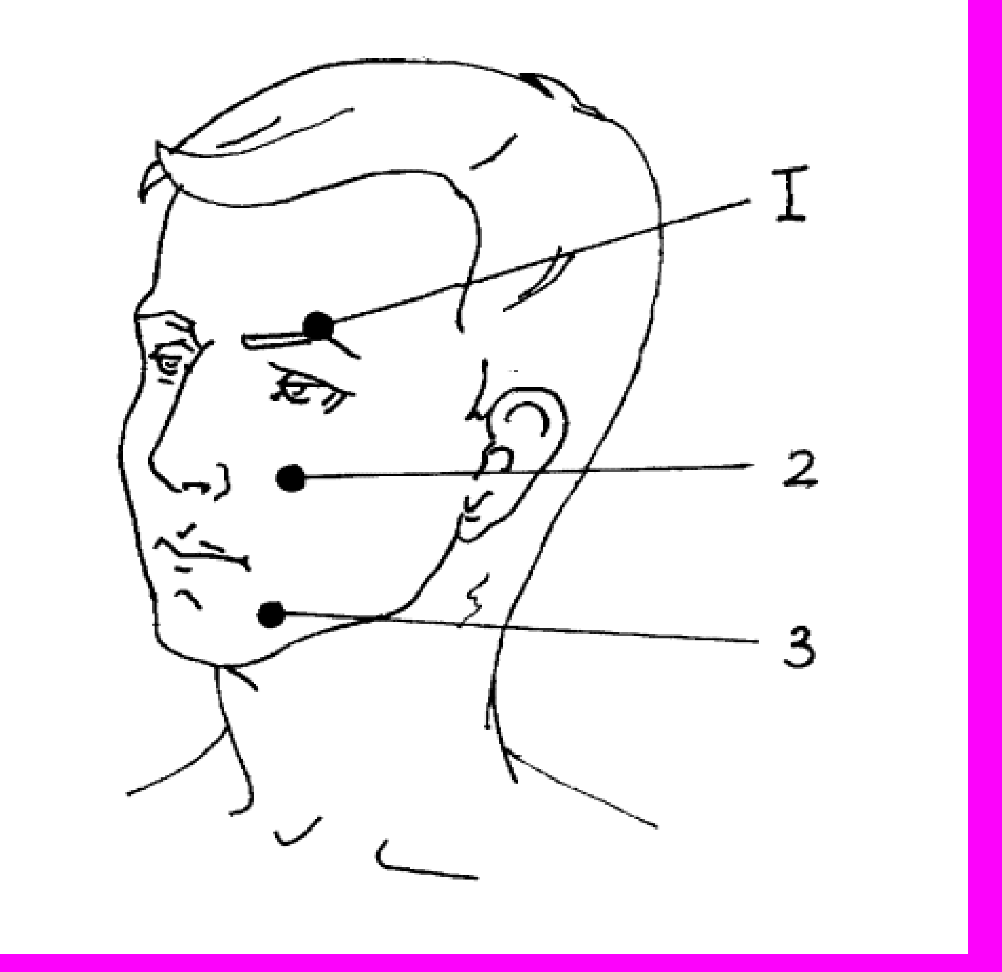 Сенсорные точки. Точки для усыпления человека. Точки на шее для усыпления человека. Сонные точки у человека. Точки выхода лицевого нерва на лице.